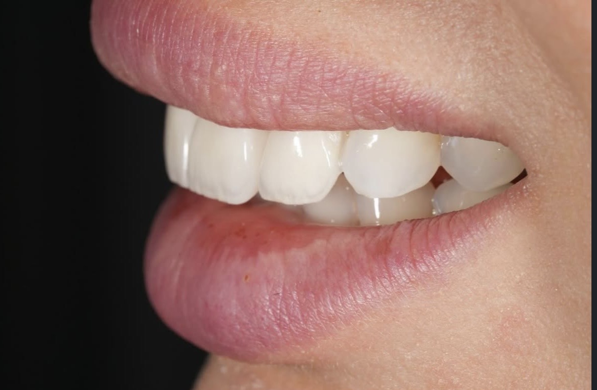 מקרה טיפול 10
